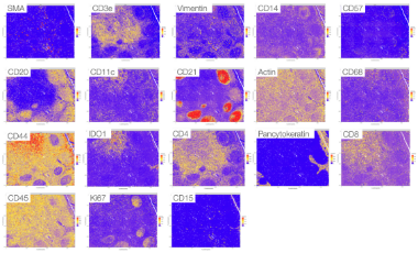Spatial Data Analysis for Multiplex Immunofluorescence