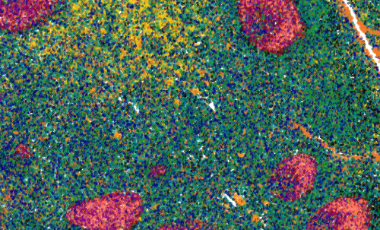 Quantitative Cell-by-Cell Multiplex Immunofluorescence Data